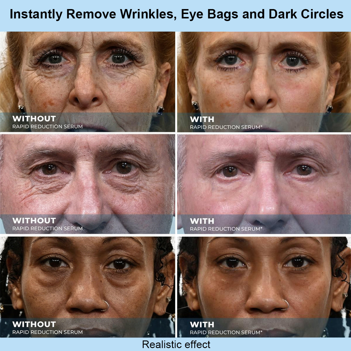 Tiworld™ Instant Face Temporary Tightener – Instant visible results in 30 seconds