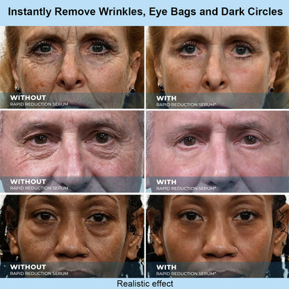 Tiworld™ Instant Face Temporary Tightener – Instant visible results in 30 seconds