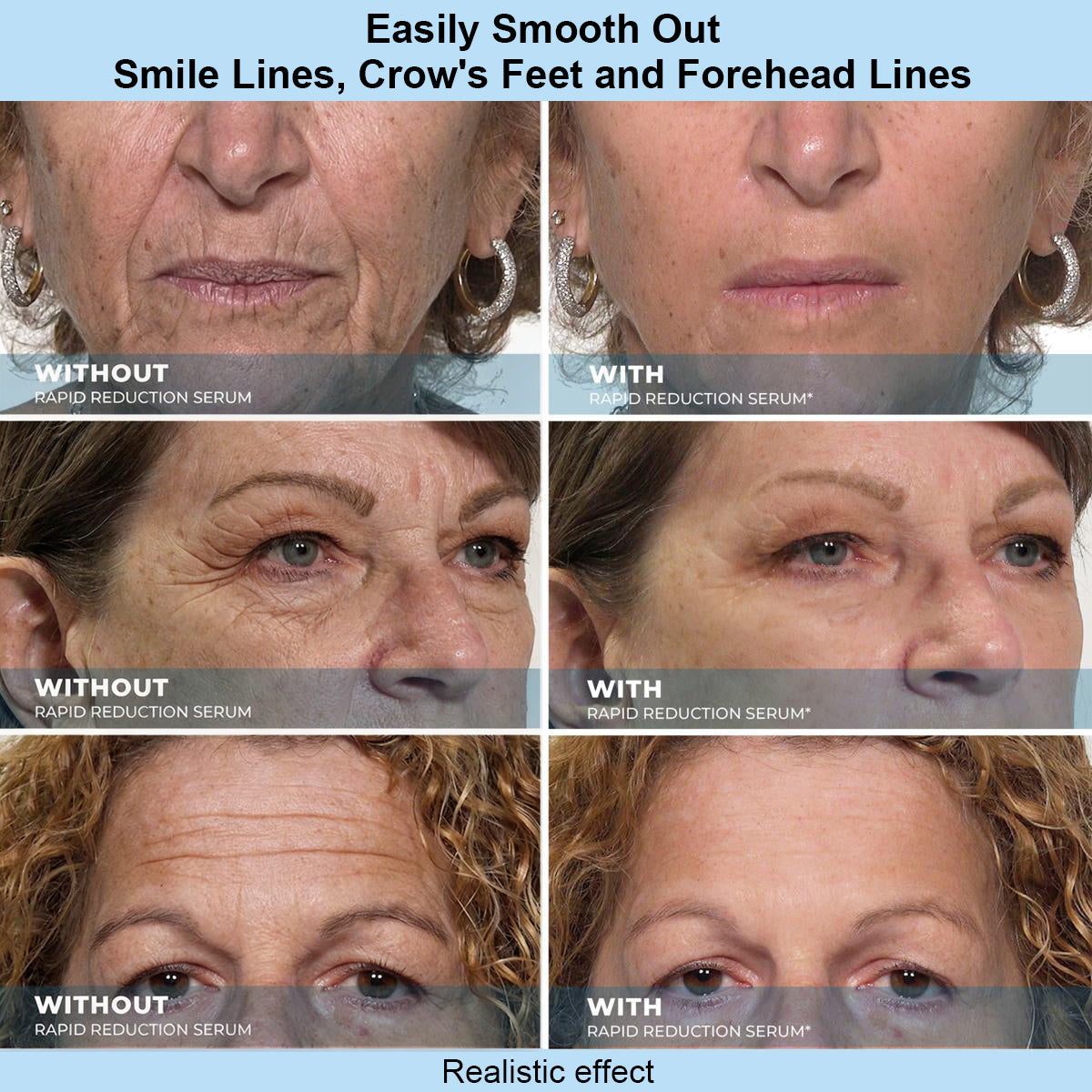 Tiworld™ Instant Face Temporary Tightener – Instant visible results in 30 seconds