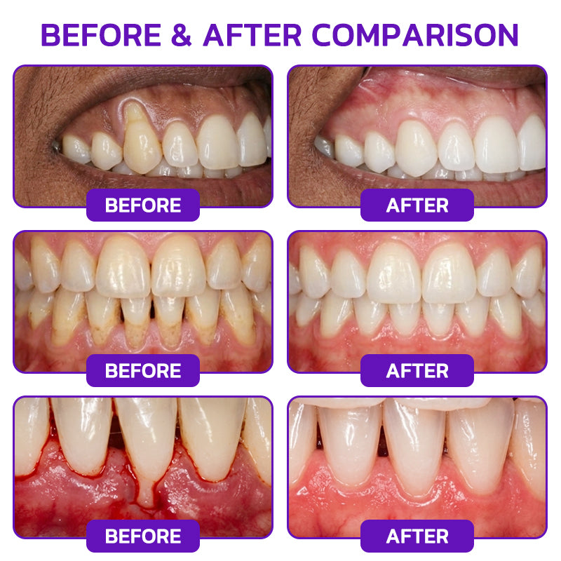 Yagoo® VioCore Bee Venom Gingivitis & Periodontitis Treatment Toothpaste