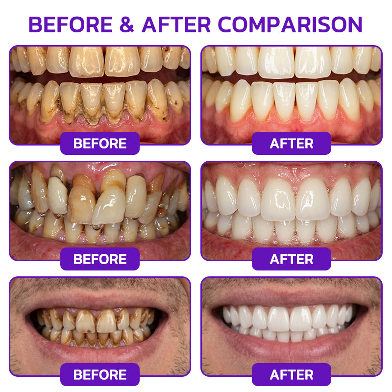 Yagoo® VioCore Bee Venom Gingivitis & Periodontitis Treatment Toothpaste