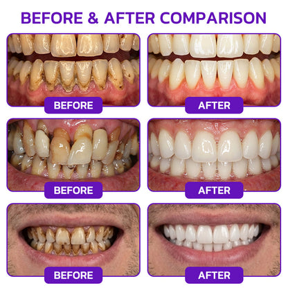 Yagoo® VioCore Bee Venom Gingivitis & Periodontitis Treatment Toothpaste