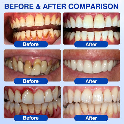 👨‍⚕️🦷🛡️Tiworld ® Gum health Periodontal Repair Gel