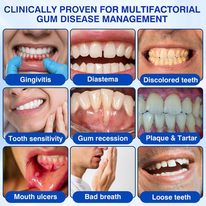 👨‍⚕️🦷🛡️Tiworld ® Gum health Periodontal Repair Gel