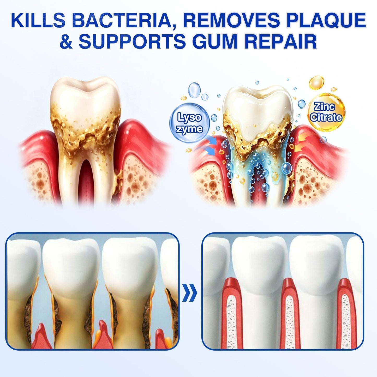 👨‍⚕️🦷🛡️Tiworld ® Gum health Periodontal Repair Gel