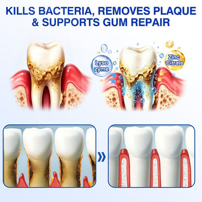 👨‍⚕️🦷🛡️Tiworld ® Gum health Periodontal Repair Gel