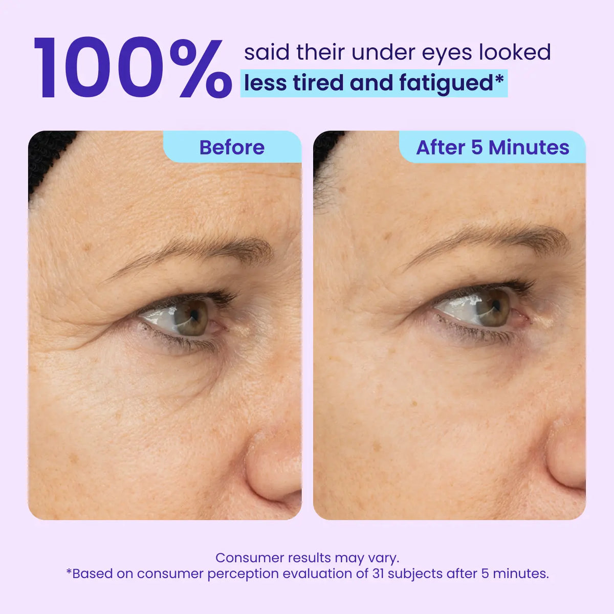 SEAGRIL | Final 3 Hours: 60%OFF🔥 Instant Lift Eye Gel for Puffiness, Bags & Dark Circles