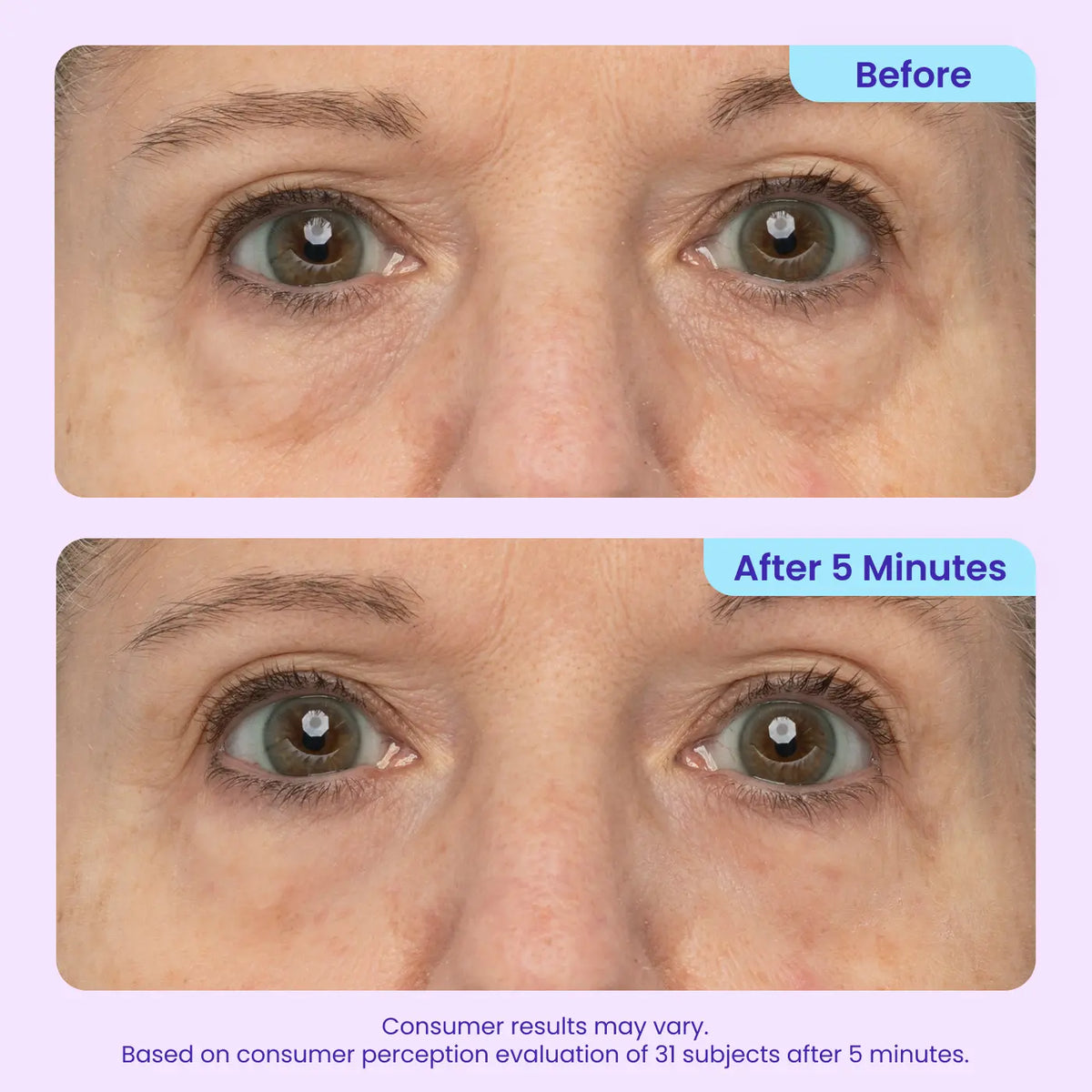 SEAGRIL | Final 3 Hours: 60%OFF🔥 Instant Lift Eye Gel for Puffiness, Bags & Dark Circles