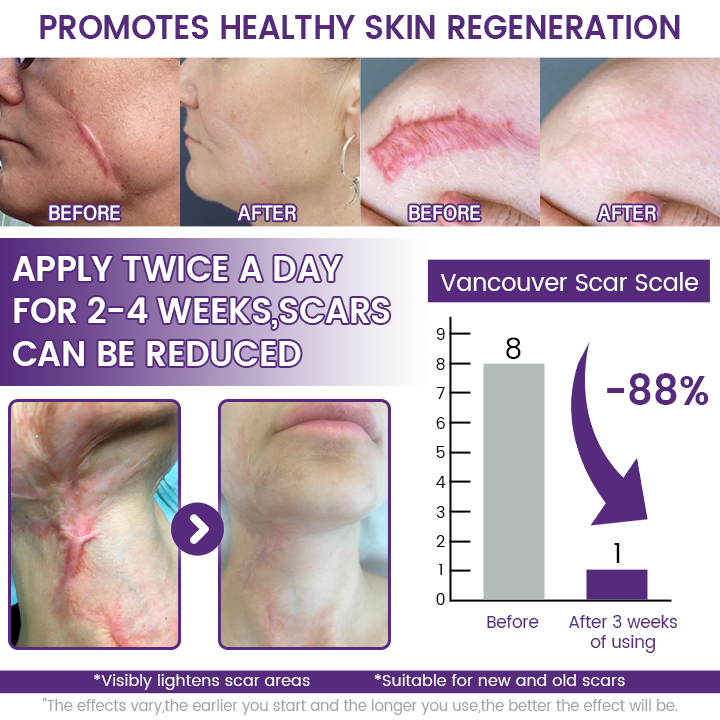 Tiworld® SkinRenew Smoothing Gel