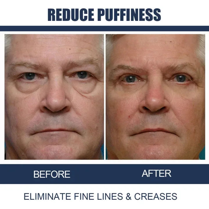 💥LAST DAY 55% OFF - Awaken Peptide Lifting Eye Gel