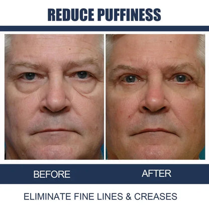 💥LAST DAY 55% OFF - Awaken Peptide Lifting Eye Gel