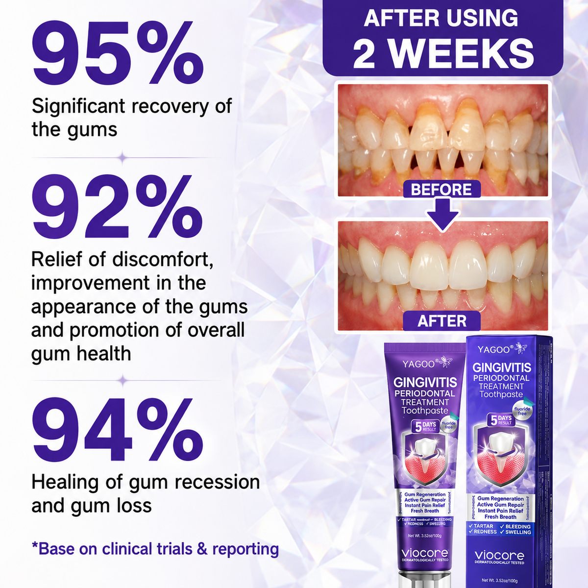 Yagoo® VioCore Bee Venom Gingivitis & Periodontitis Treatment Toothpaste