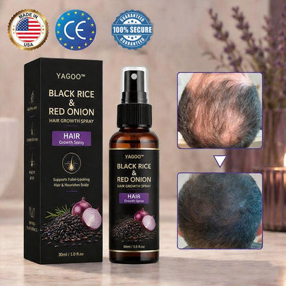 🔥Yagoo™ Black Rice & Red Onion Hair Growth Spray