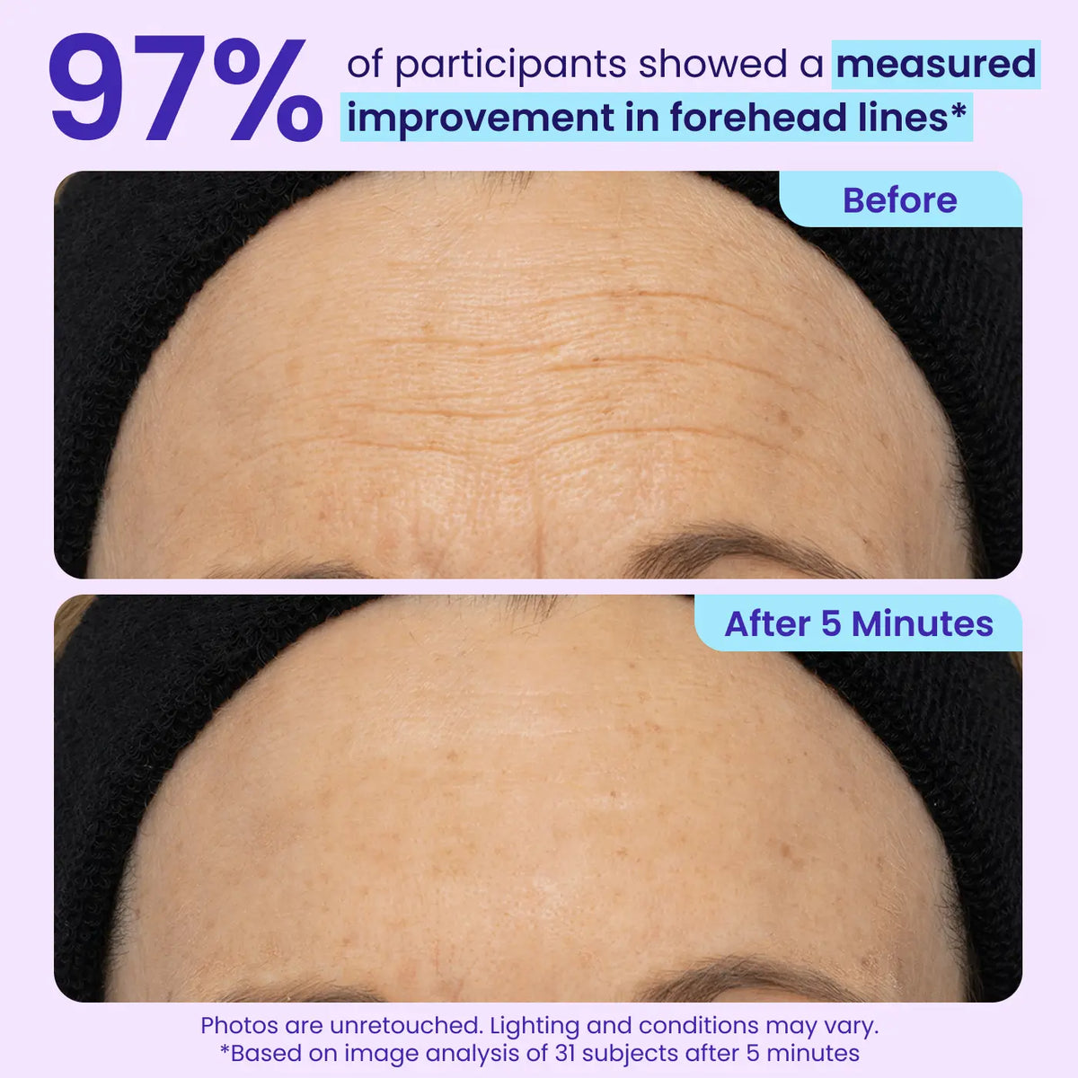 SEAGRIL | Final 3 Hours: 60%OFF🔥 Instant Lift Eye Gel for Puffiness, Bags & Dark Circles