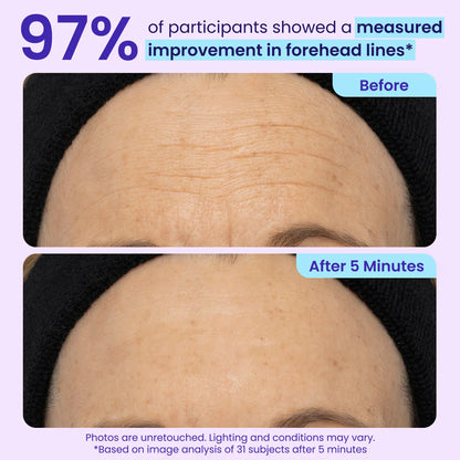 SEAGRIL | Final 3 Hours: 60%OFF🔥 Instant Lift Eye Gel for Puffiness, Bags & Dark Circles