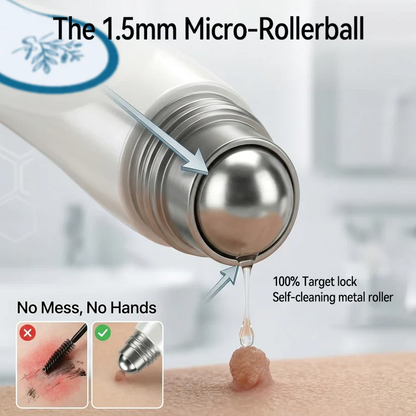 FDA Registered Facility | Tiworld® 7-Day Skin Tag & Spot Eraser Painless & Scar-Free Advanced Imperfection Removal Rollerball Pen